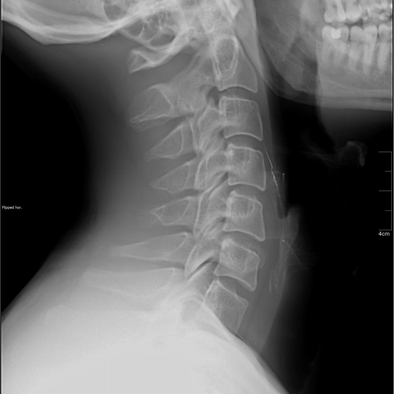 About Us Kaplan Chiropractic